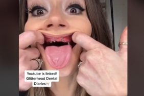 TikTok dentures